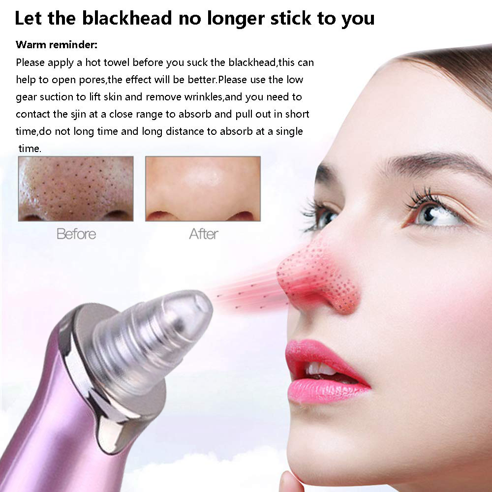 Electric Blackhead Remover Pore Vacuum Suction Diamond Dermabrasion Face Cleaner 3