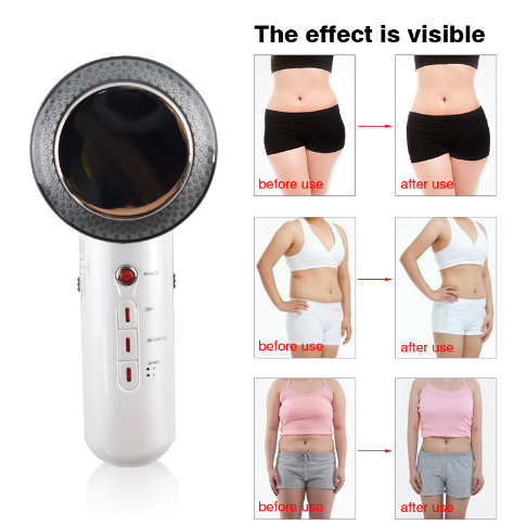 Beauty Care Slimming Device Handheld Ultrasound Body Fat Remove Massager 3